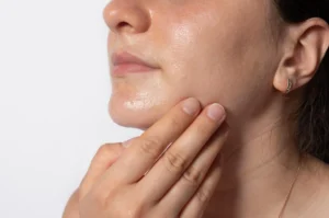 Mulher com pele oleosa tocando o queixo, demonstrando preocupação com o efeito rebote na pele após uso de produtos inadequados.